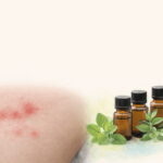 帯状疱疹のアロマケアをイメージした精油ボトルとハーブのイメージ